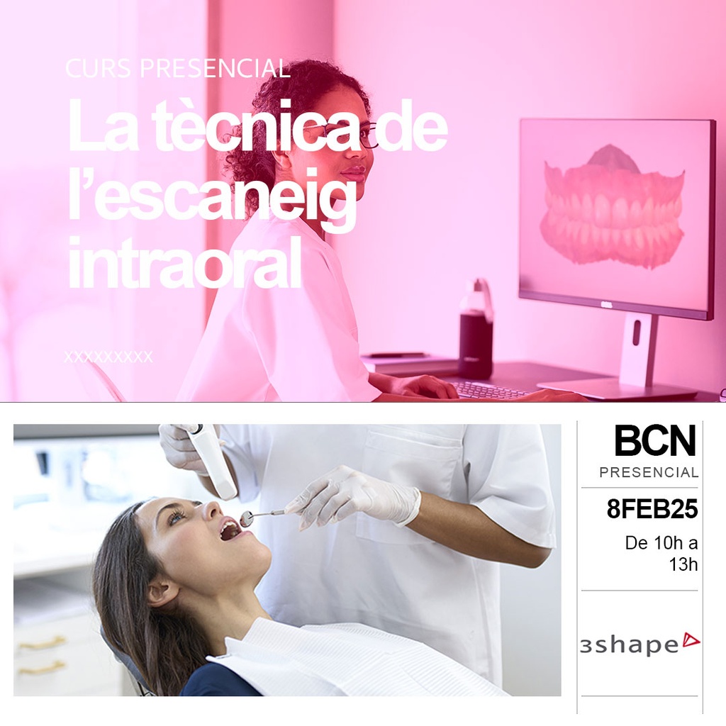 La tècnica de l'escaneig intraoral